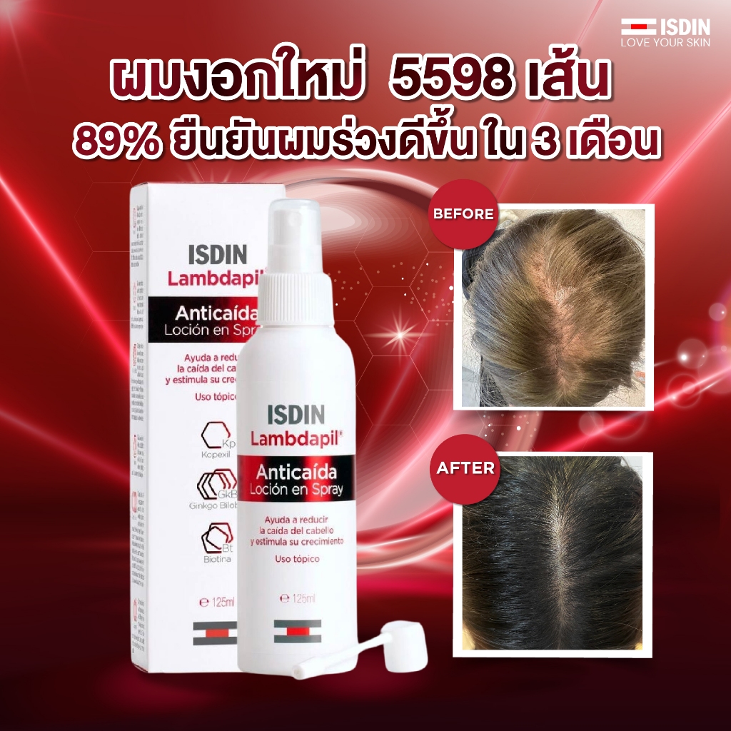10 อันดับ ทรีทเมนต์บำรุงรากผม ขายดีที่สุดใน Shopee